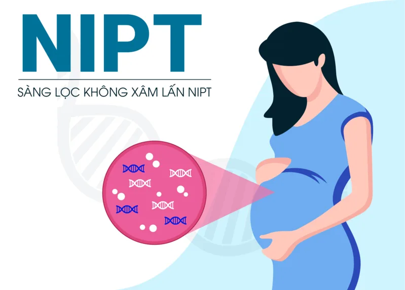 Sàng lọc và chẩn đoán hội chứng Down cần được thực hiện bằng xét nghiệm y khoa phù hợp và có tư vấn chuyên môn.